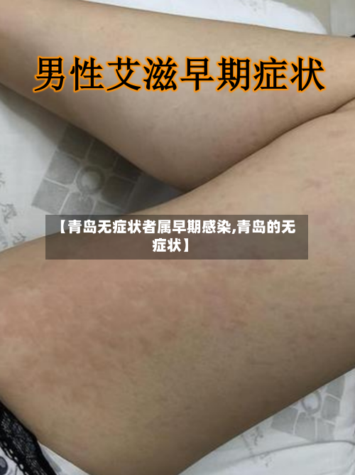 【青岛无症状者属早期感染,青岛的无症状】-第2张图片
